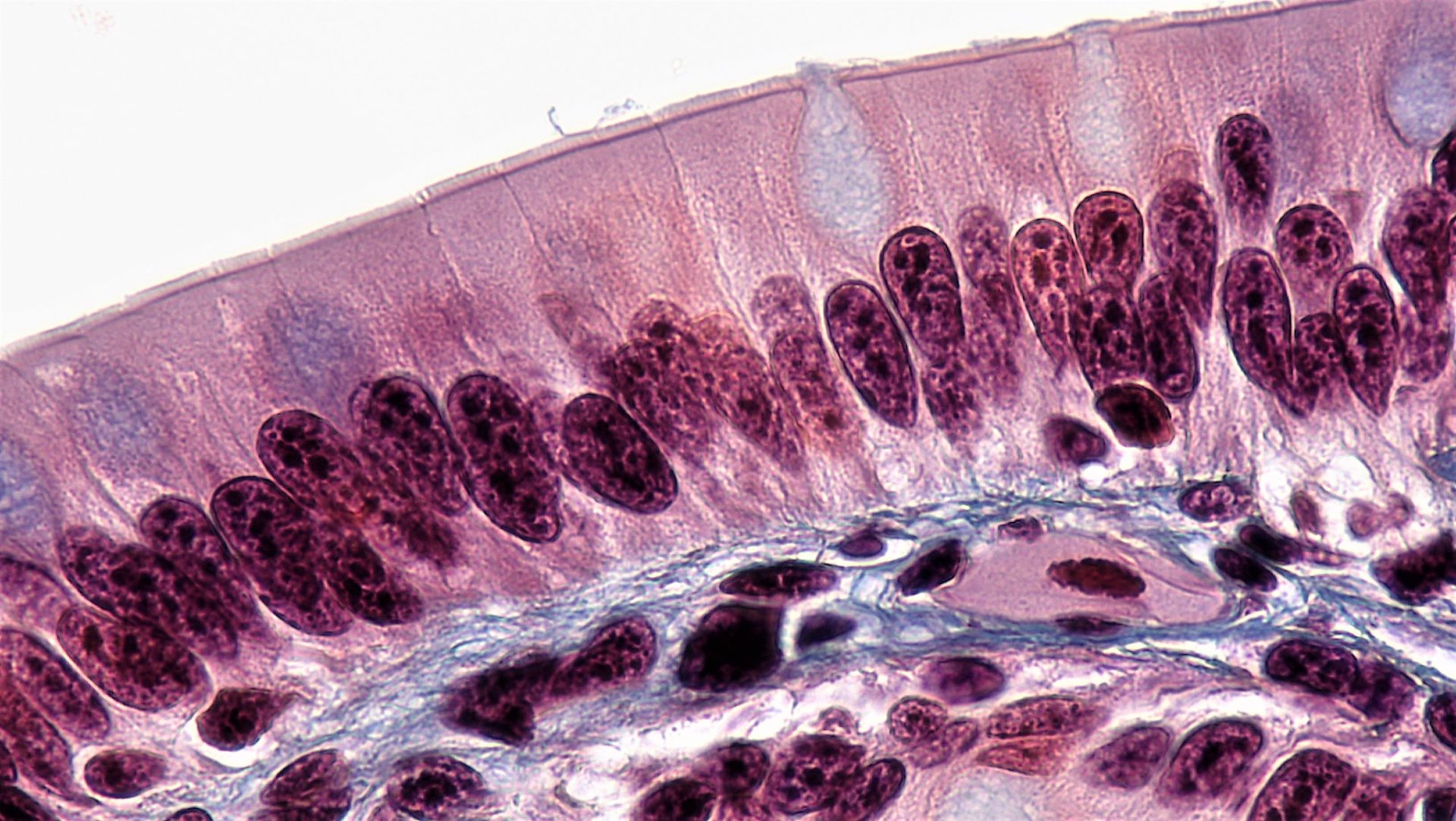 Intestinal cell with brush border Specialized proteins with long cytoplasmic tails