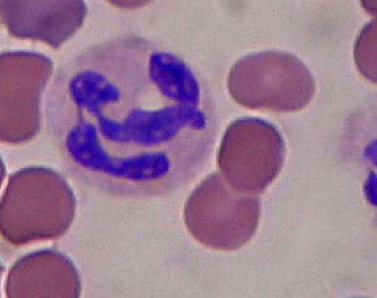 Neutrophil_in_a_blood_smear Neutrophil in a blood smeae